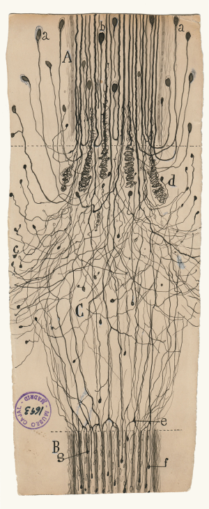 A cut nerve outside the spinal cord, 1913, Santiago Ramón y Cajal, Cajal Institute, Madrid.